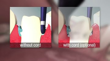 3M Astringent Retraction Paste