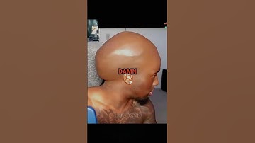 Streamers Who Have BIG Foreheads! 🧠