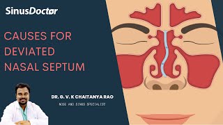 Causes for DNS | Deviated nasal septum  Dr.GVK Chaitanya Rao