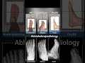 99% लोग ने ऐसा view नहीं किया होगा।best posting in x ray examination,ap view , oblique view, lateral
