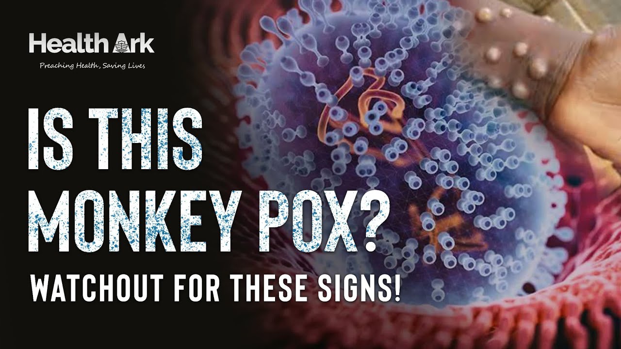 Monkeypox virus: Introduction, causes signs and symptoms #mpox # ...