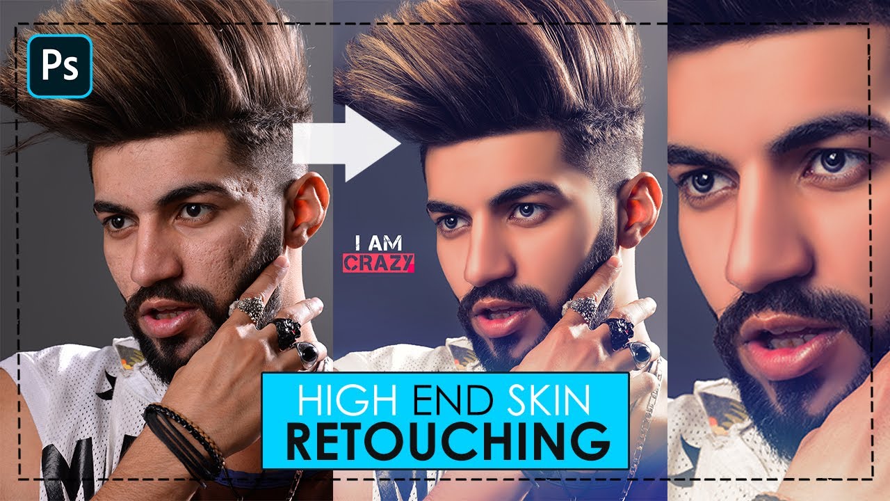 High-End Skin Retouching in Photoshop