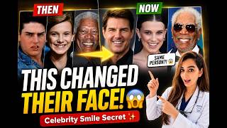 This changed their face😱 Celebrity Smile Secret🔥#SmileTransformation #TheWholeToothwithdrdarshana