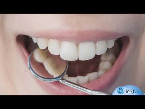 Перекись водорода для зубов - чем она полезна?