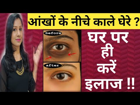 वीडियो: सोडा कैन का घेरा क्या होता है?