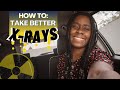 How to take better xrays  ask the rad tech