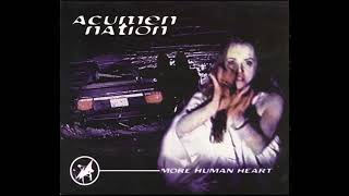 Watch Acumen Nation Ugly On The Inside video