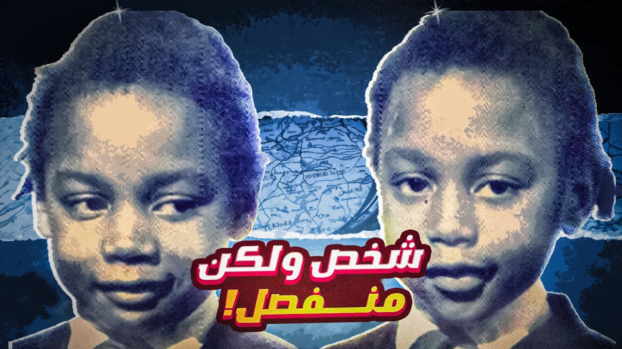 توأم انولدوا منفصلين ولكن حياتهم واحدة | اغرب قصة مرت علي!