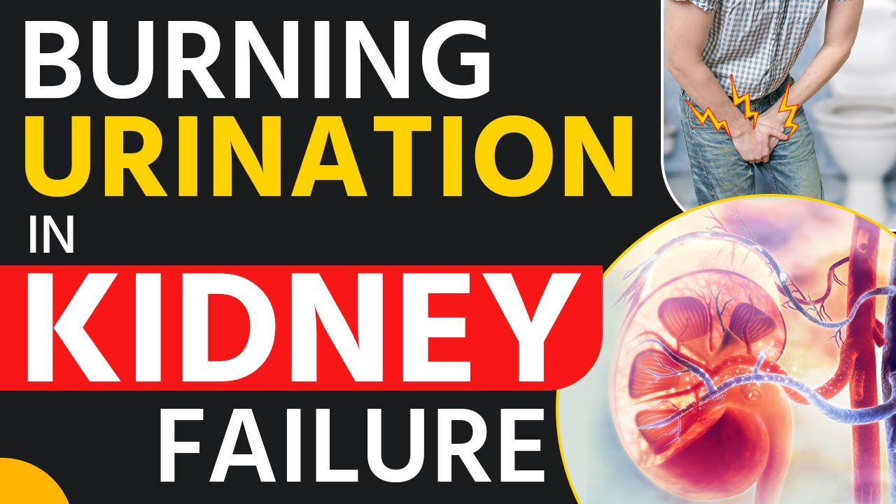 Burning Urination In Kidney Failure Chronic Kidney Disease (CKD) In