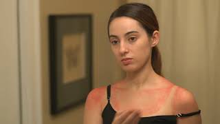 How to prevent and treat common summer rashes