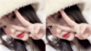 ☆ . . V-LINE surgery effect ♡ ᝰ