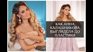 Как выглядела Анна Калашникова до пластики