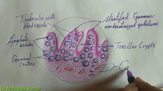Histology of Palatine tonsil\Tonsil
