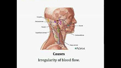 pulsatile tinnitus treatment