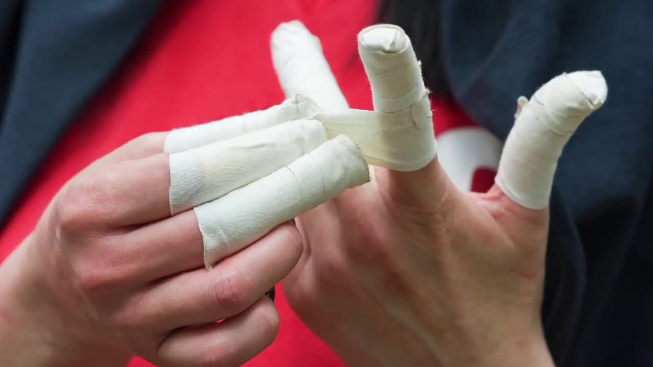 PROTEÇÃO DE ESPARADRAPO PARA QUEM TEM MUITO PELO NO BRAÇO 