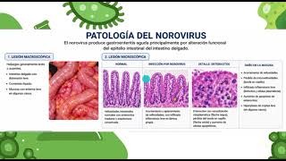 VIDEO EXPOSICIÓN DE NOROVIRUS