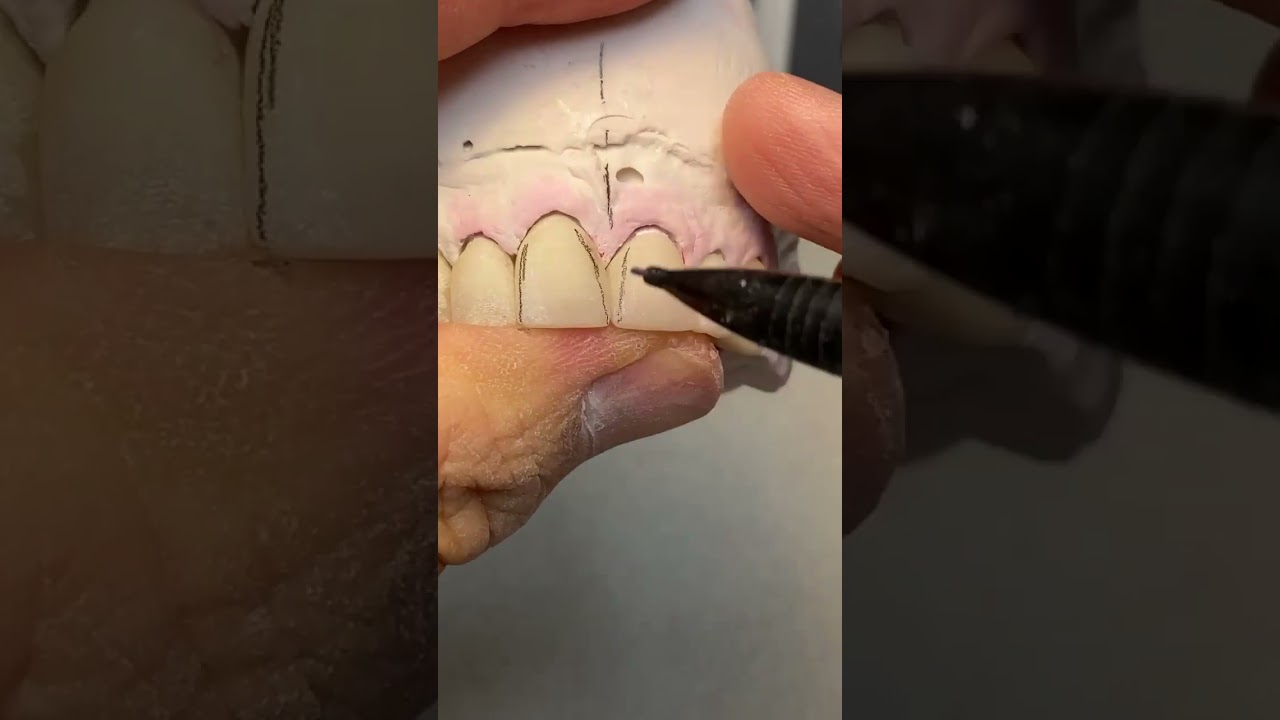 Grattage la  ceramic