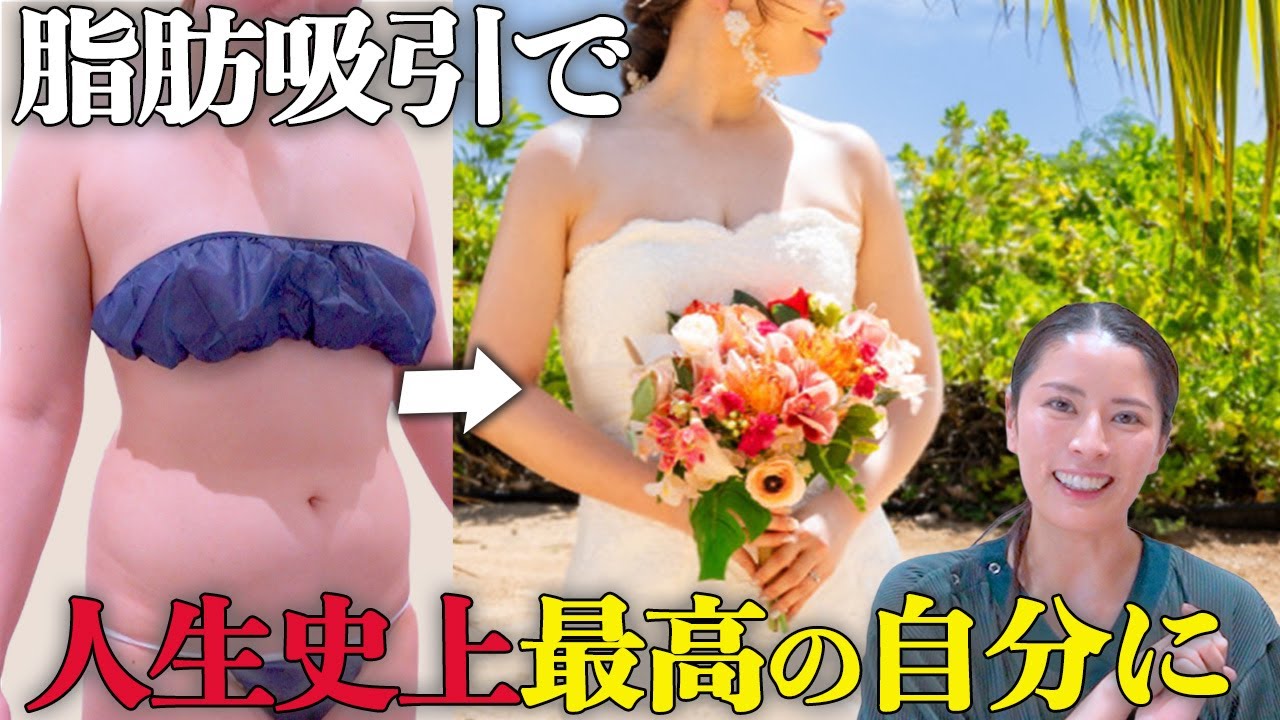 脂肪吸引後にウェディングドレスを着て人生最高の日に✨