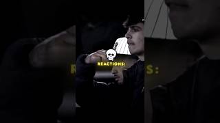 Reactions on Yamal injury ☠️