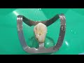 Operatoria dental y endodoncia tcnicas y materiales15instrumentacin de conductos