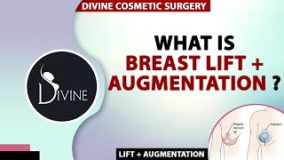 What is Breast Lift + Augmentation | Plastic Surgery India