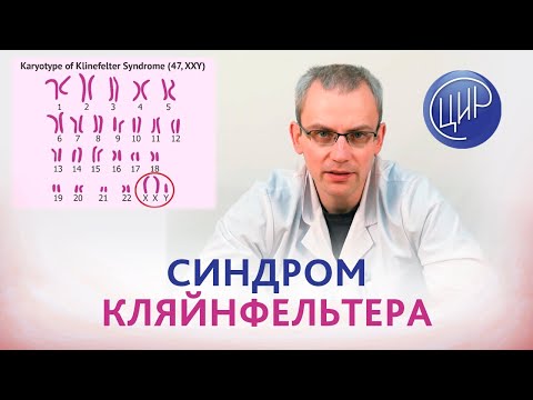 Синдром Кляйнфельтера. Причины азооспермии. Мужское бесплодие. Уролог-андролог ЦИР Живулько А.Р.
