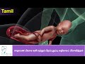 Quiz om Video Tutorial