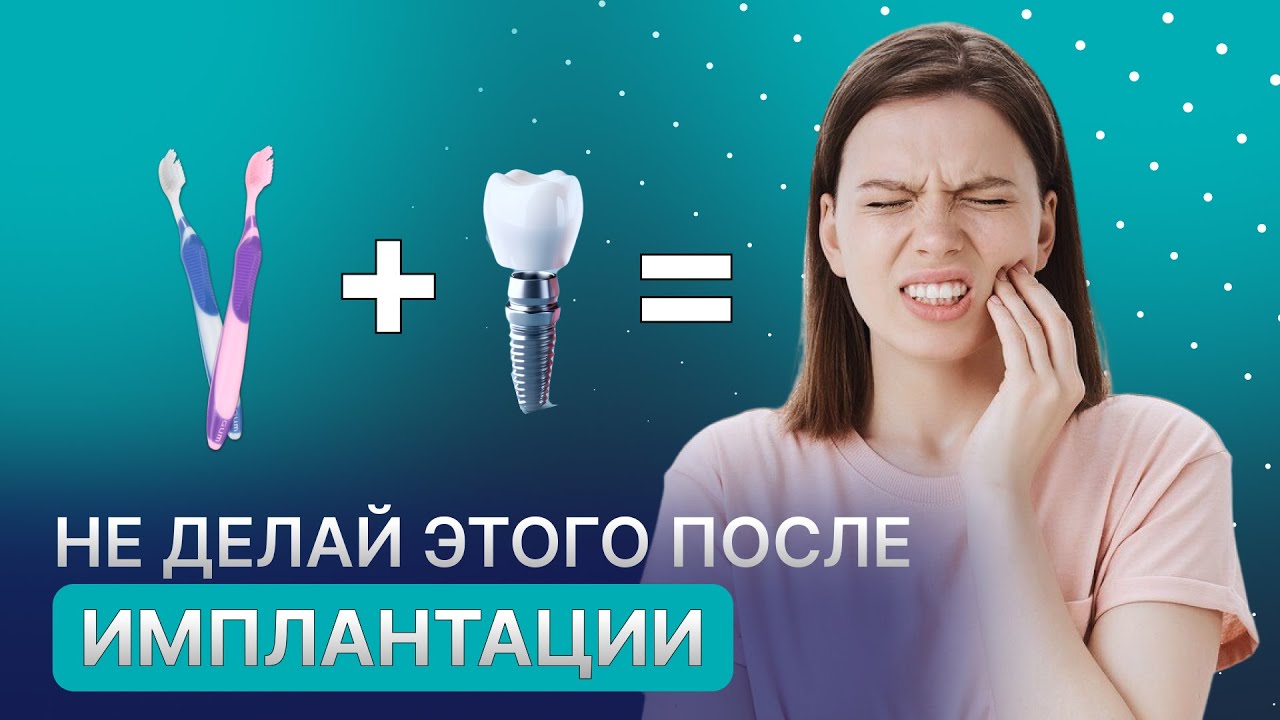 Как избежать осложнений после имплантации? Правильное восстановление!