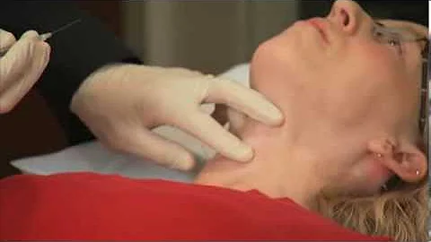 Laryngeal Botox Injection - Dr. Ekbom at Mayo Clinic