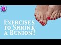 Exercises to Shrink a Bunion