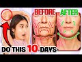 This 1 Simple Exercise Lifts Your Entire Face🔥99% Don’t Know This Face Lifting Technique