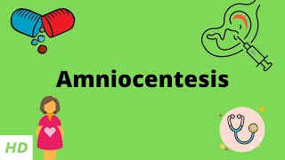 Amniocentesis, Causes, Signs and Symptoms, Diagnosis and Treatment.