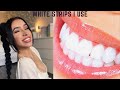 HOW TO WHITEN TEETH AT HOME FAST & CHEAP | Crest 3D White Strips vs HiSmile [Before + After Review]