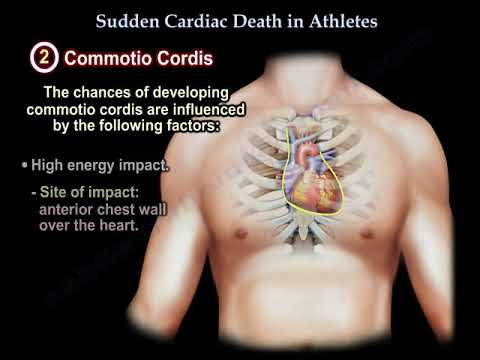 Video: Commotio Cordis: Sümptomid, Põhjused, Esmaabi, Outlook Ja Palju Muud