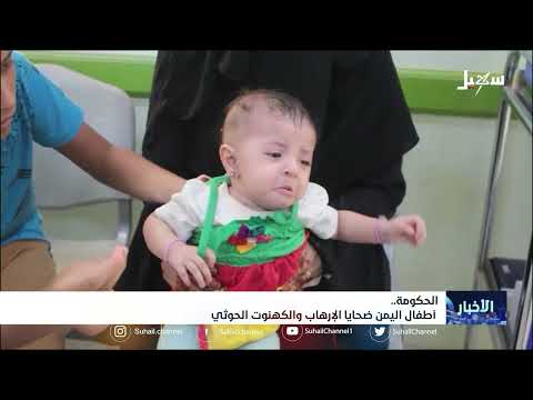 أطفال اليمن ضحايا الإرهاب والكهنوت الحـ... . ــوثي