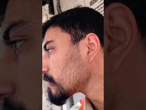 100 يوم من الإستعمال