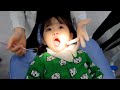 [SUB] 손가락 빠는 아이의 첫 치과 검진! 🦷🦷  (22개월 루다)