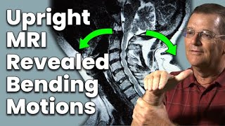 See How Upright MRI Captures Bending in Multiple Positions