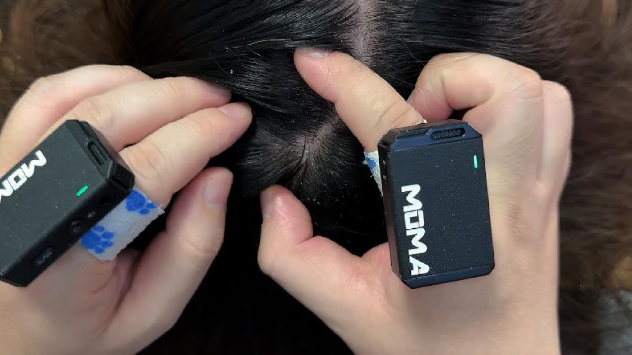 ASMR Tweezers & Short Nail Scalp Check: Insanely Satisfying Dandruff Removal