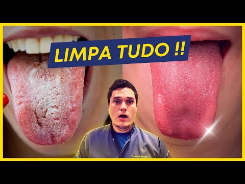 Vídeo: Como limpar sua língua corretamente: 11 etapas (com fotos)