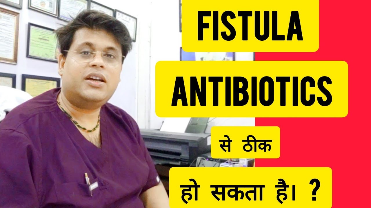 क्या फिसचुला सिर्फ़ antibiotic  से ठीक हो सकता है।  ? ( Can fistula be cured by antibiotics alone?