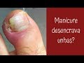 Manicure é obrigada a desencravar as unhas das clientes?