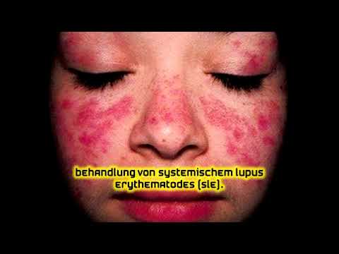 Video: Behandlung Von Systemischem Lupus Erythematodes