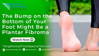 The Bump On The Bottom Of Your Foot Might Be A Plantar Fibroma