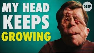 Famous 'There's No Cure' | DEEP Net Worth