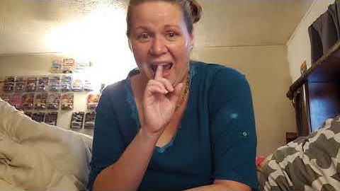 Loving my cast metal with resin partial upper denture - almost 1 month out.