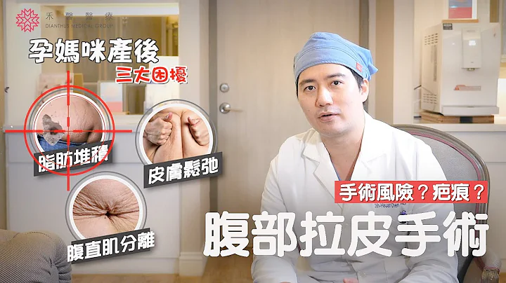 【產後恢復QA】產後肚子回不去?脂肪、鬆弛、腹直肌分離~解決三大問題搶救鬆肚皮！ ｜腹部拉皮、抽脂｜陳志軒醫師｜禾馨形體美學 - 天天要聞