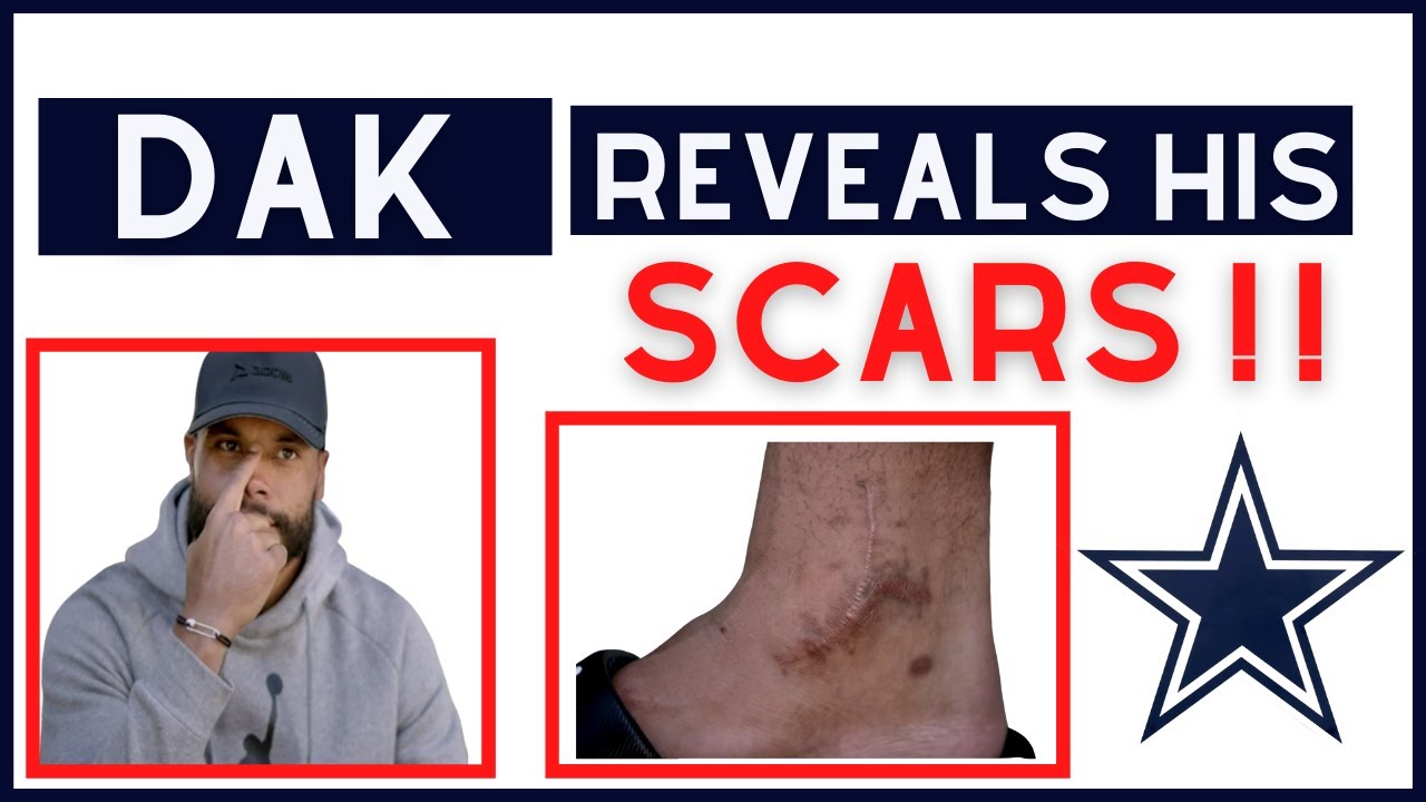 Dak Reveals his SCARS Hard Knocks Highlights YouTube
