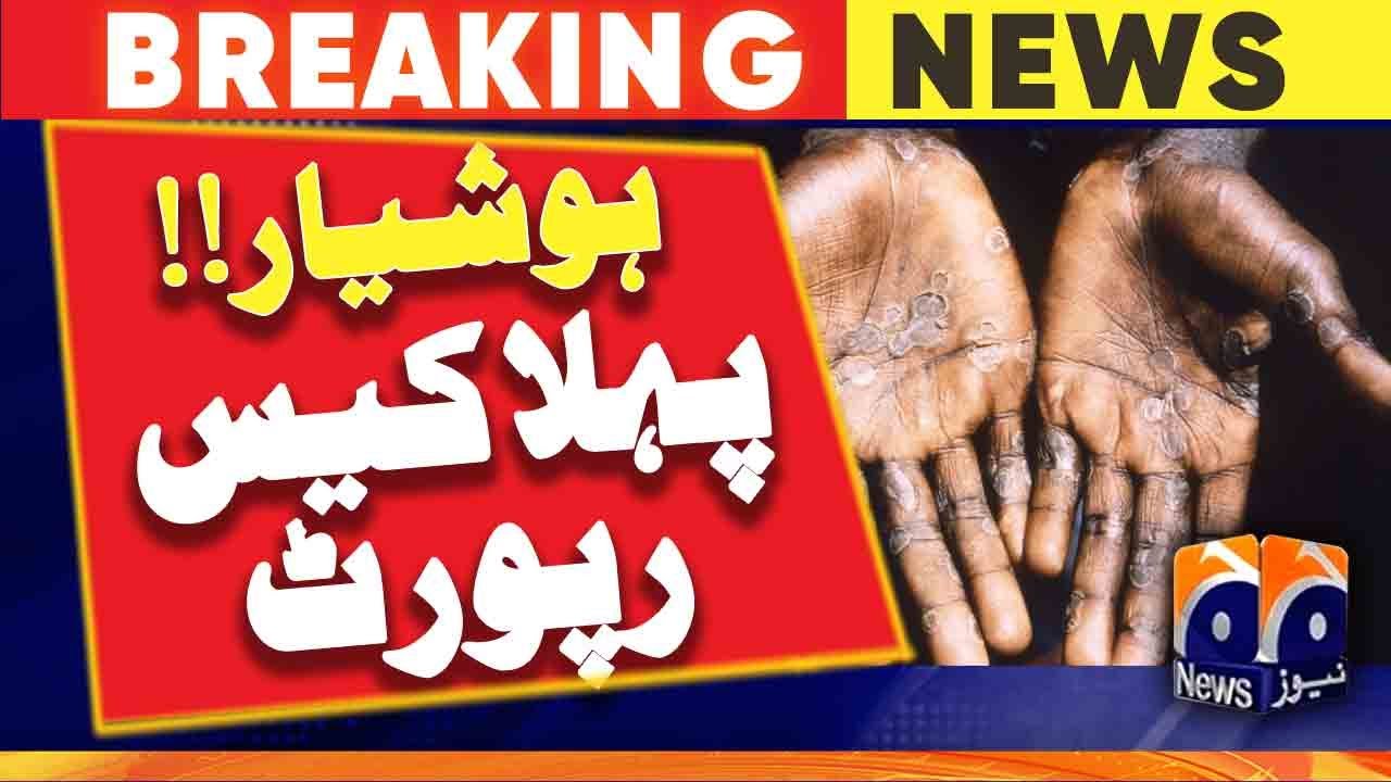 First case of monkeypox was reported in Pakistan | Geo News - YouTube