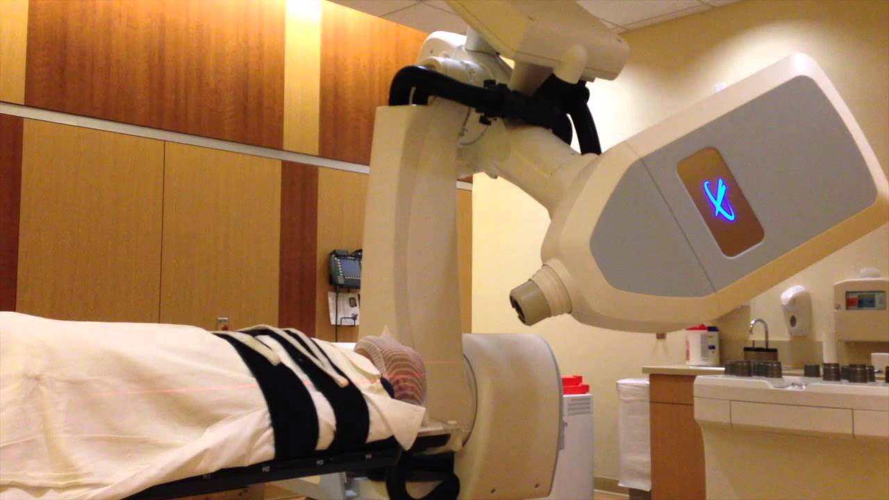 CyberKnife Procedure Treatment for Glioblastoma Multiforme (GBM
